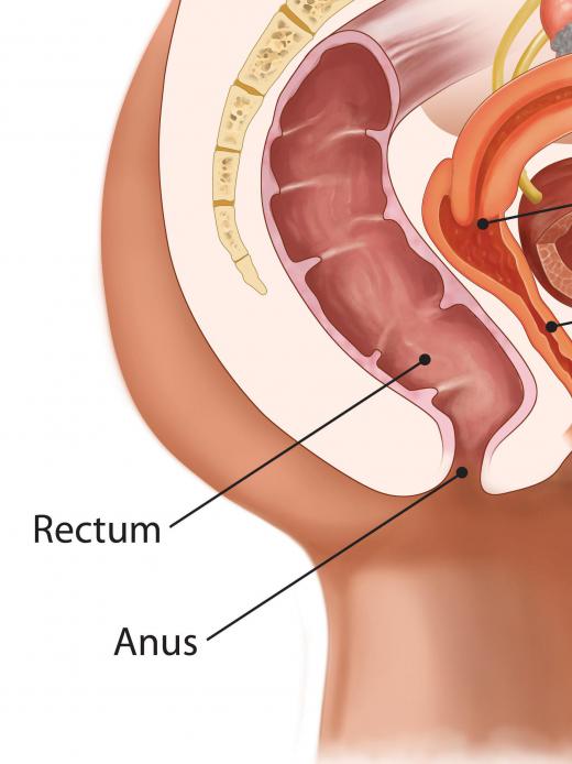 Liquid and medication will be administered rectally during enema suppository treatment.