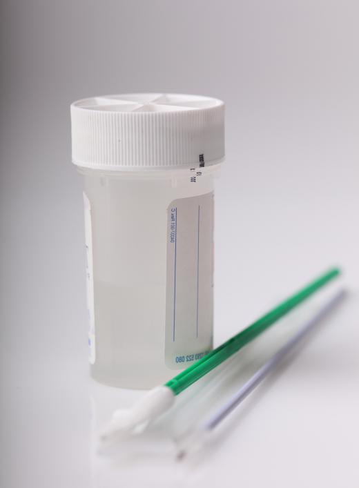 Men may order at home STD-testing kits which include penis swabs.