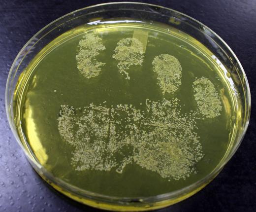 Drug-resistant bacterial may be identified using a bacterial culture.