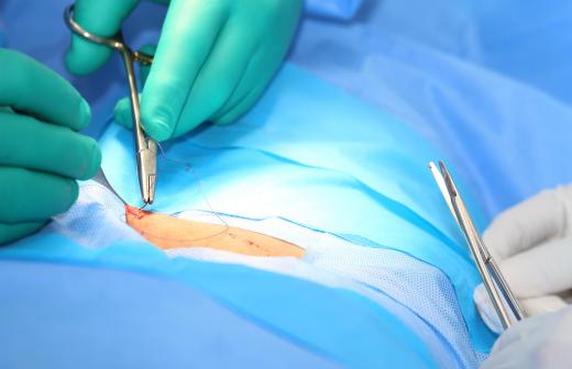 A dorsal slit incision must be kept clean in order to avoid infection.