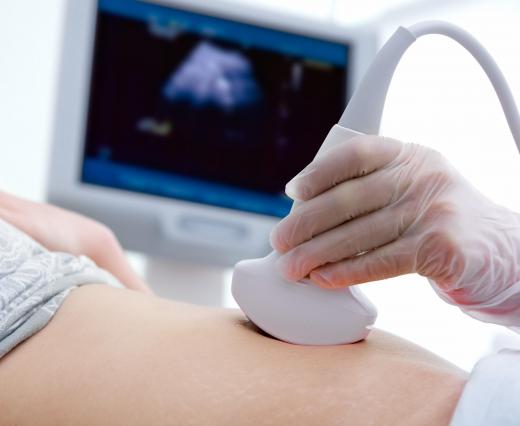 Ultrasound technology can be used to diagnose and treat kidney stones.