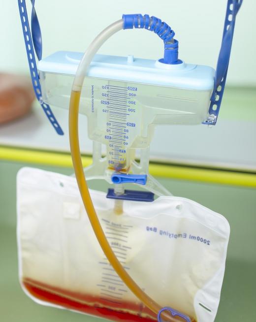 Patients who require a catheter for urine drainage are at an increased risk for infections caused by Klebsiella oxyoca.