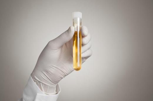 Legionella tests include the collection of a urine sample.