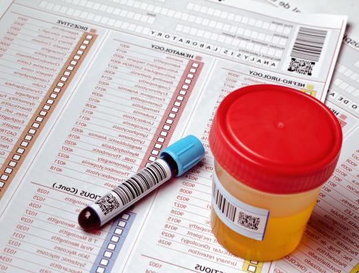 Blood and urine samples are often collected to check for abnormally high levels of porphyrins.