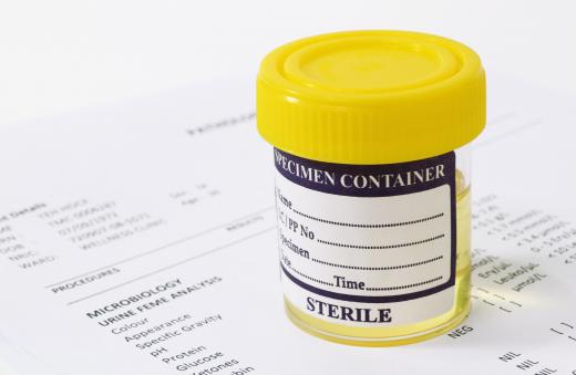 A urinalysis can be used to help diagnose many urinary system diseases.