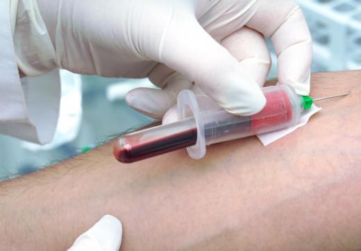 Blood tests are used to diagnose syphilis.