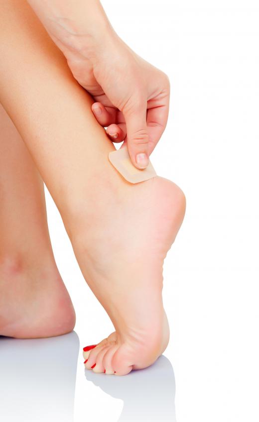 Blistering on the feet is a common problem with wearing high heels.