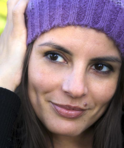 Woman with a beauty mark, or compound nevus.