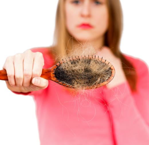 Birth control pills may cause hair loss in women.