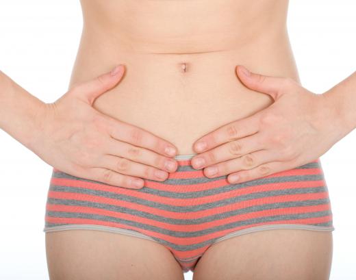 Some women who have a uterine polyp will experience no symptoms or signs of the growth.