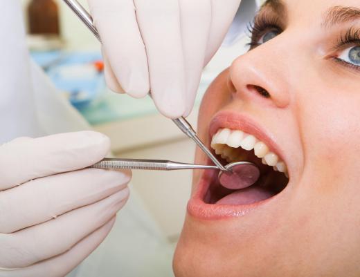 A dentist fixing a chipped tooth.