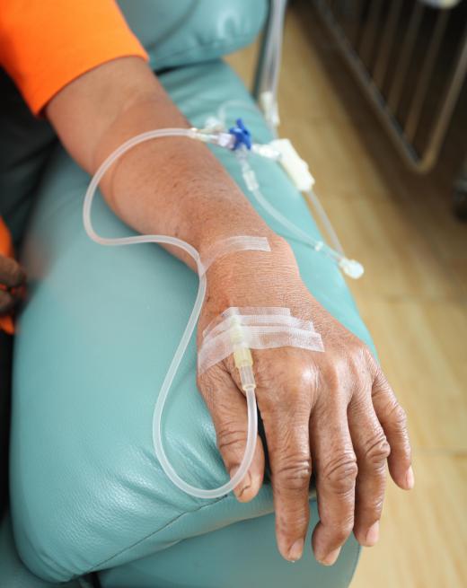 AC chemotherapy treatments are normally given intravenously.