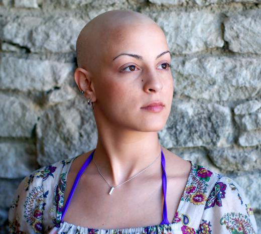 Chemotherapy causes hair loss by interrupting the hair growth cycle.