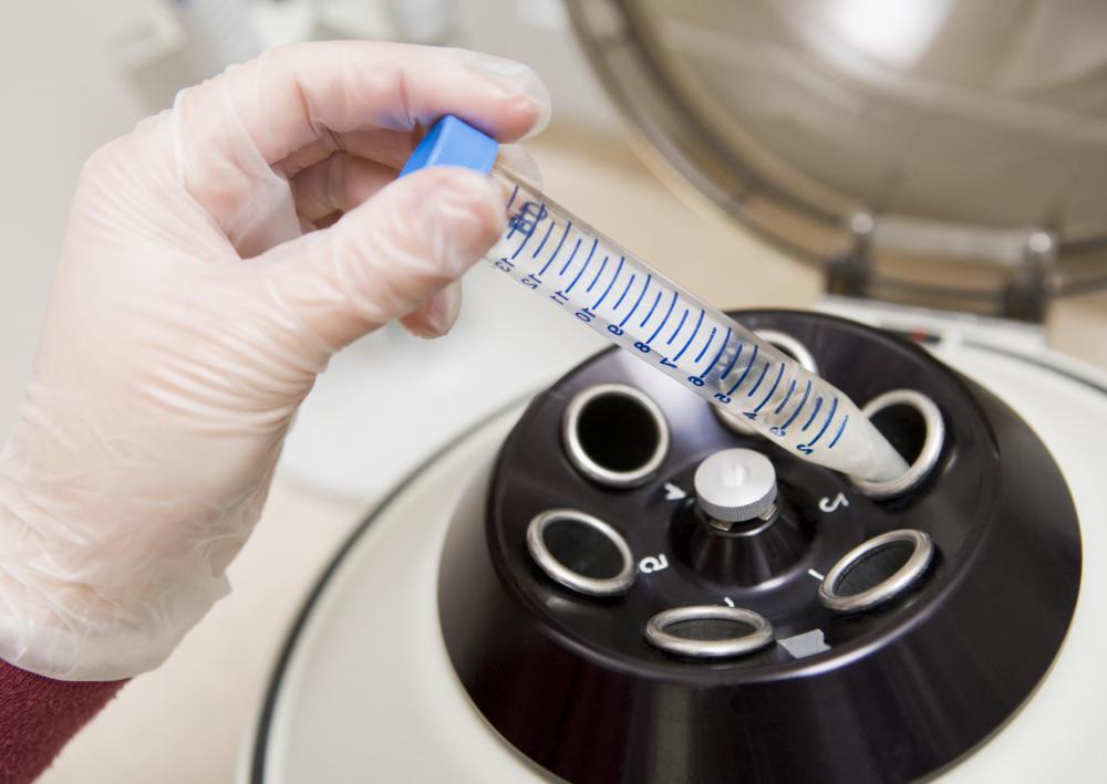 What is Tissue Homogenization? (with pictures)